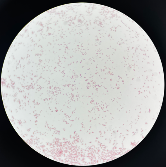 制藥行業(yè)中的隱形殺手-洋蔥伯克霍爾德菌群 制藥行業(yè)中的隱形殺手-洋蔥伯克霍爾德菌群