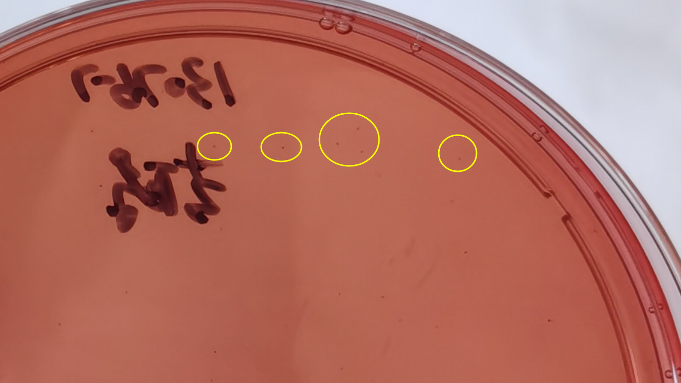 VRBA內(nèi)的紅色小菌落，有可能是沙門氏菌？